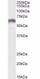 Goat anti-MMP3 (aa459-473) Antibody