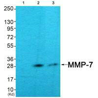 MMP7 antibody