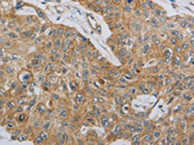 MMP8 Antibody
