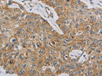 MMP8 antibody