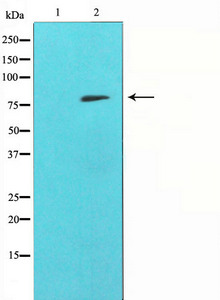 MMP9 Antibody