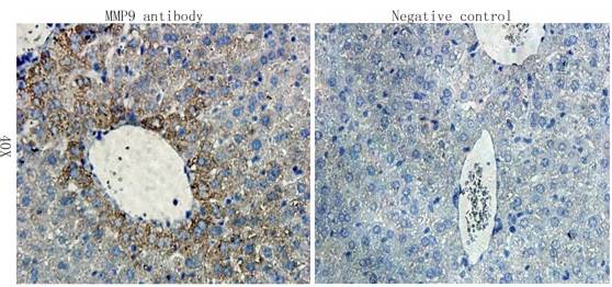 MMP9 antibody