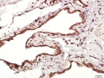 MMRN1 Rabbit Polyclonal Antibody