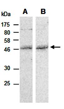 MMS21 (C) Antibody, Rabbit Polyclonal
