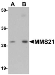 MMS21 Antibody