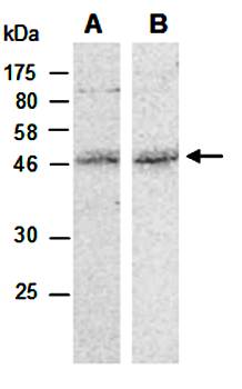 MMS21 antibody pair