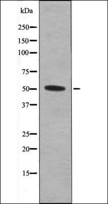 MNK1 (Phospho-Thr250) antibody