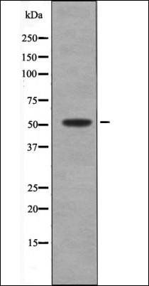 MNK2 (Phospho-Thr24) antibody
