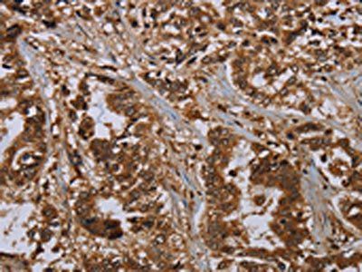 MOB1A Antibody