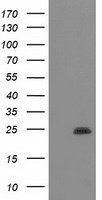 MOBKL2B (MOB3B) antibody