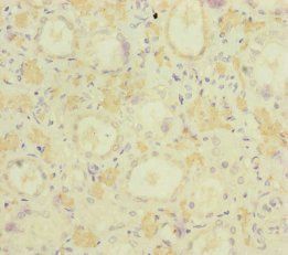 MOCS2 Antibody