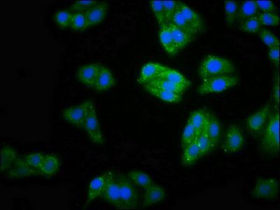 MOCS2 antibody