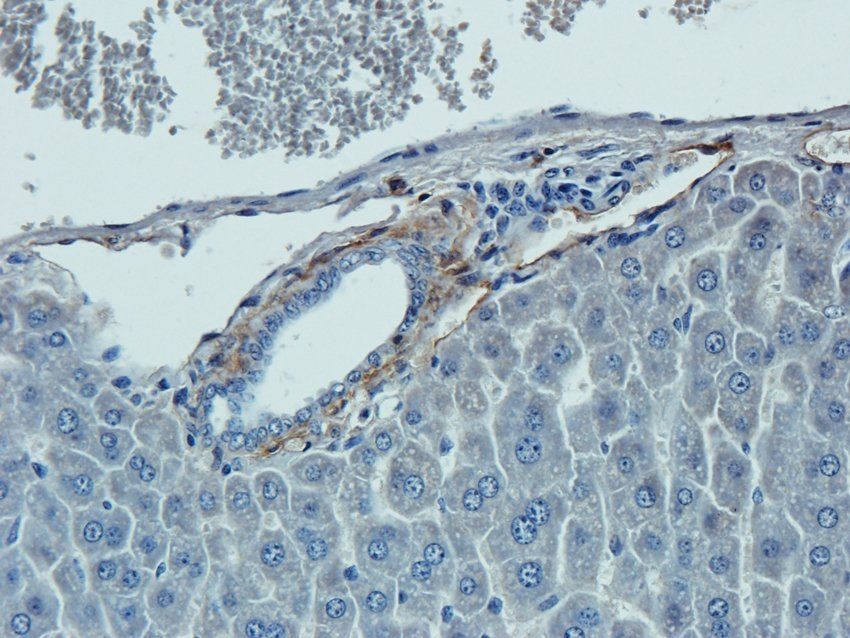 MOGAT1 antibody