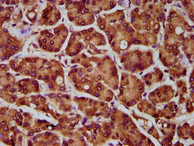 MOGAT1 Antibody
