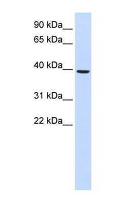 MOGAT2 antibody
