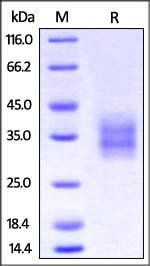 Cynomolgus / Rhesus macaque 4-1BB / TNFRSF9 Protein