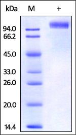 Rhesus macaque EGF R Protein, His Tag