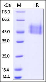 Cynomolgus IL-4 R alpha Protein, His Tag