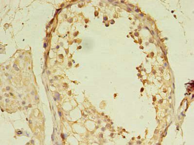 MORC2 antibody