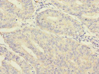 MORN5 Antibody