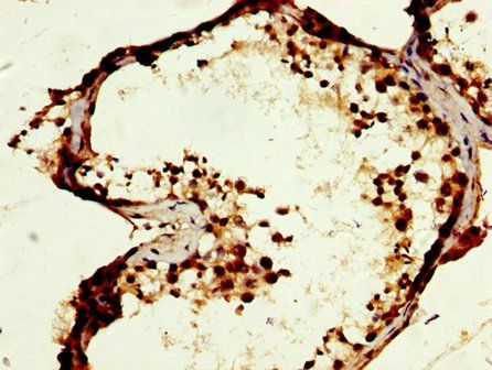 MOS Antibody