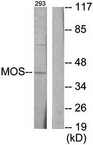 MOS antibody