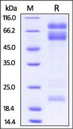 Mouse ADAM17 / TACE / CD156b Protein