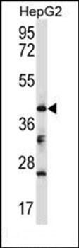 Mouse Bckdk antibody