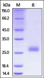 Mouse CTLA-4 Protein, His Tag