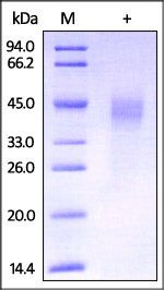 Mouse Dkk-1 Protein, His Tag
