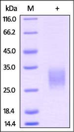 Mouse GITR / TNFRSF18 Protein