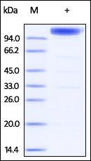 Mouse IL-6 R beta Protein, Fc Tag