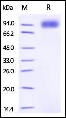 Mouse IL-6 R beta Protein, His Tag