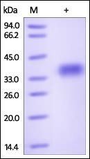 Mouse GPA33 / A33 Protein