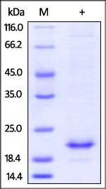 Mouse IL-10 Protein, His Tag