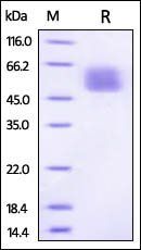 Mouse IL-13 R alpha 1 Protein, His Tag