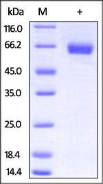 Mouse IL-4 R alpha Protein, Fc Tag