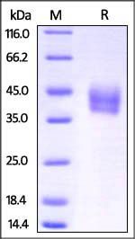 Mouse IL-4 R alpha / CD124 Protein