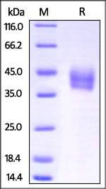 Mouse IL-4 R alpha Protein, His Tag