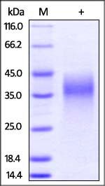 Mouse LIF Protein, His Tag