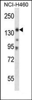 Mouse Myo3b antibody