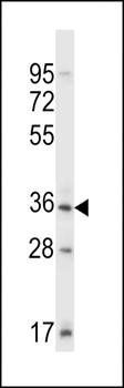 Mouse Sgk110 antibody