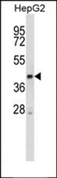 Mouse Stk25 antibody