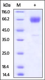 Mouse TIM-3 / HAVCR2 Protein