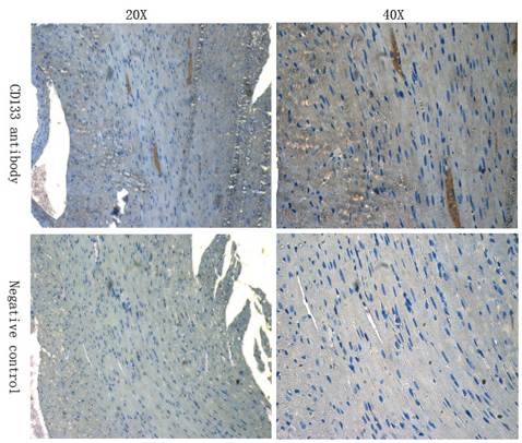 CD133 Rabbit Polyclonal Antibody