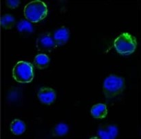ROR1 Antibody