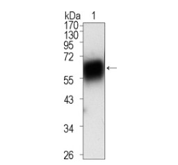 ROR1 Antibody