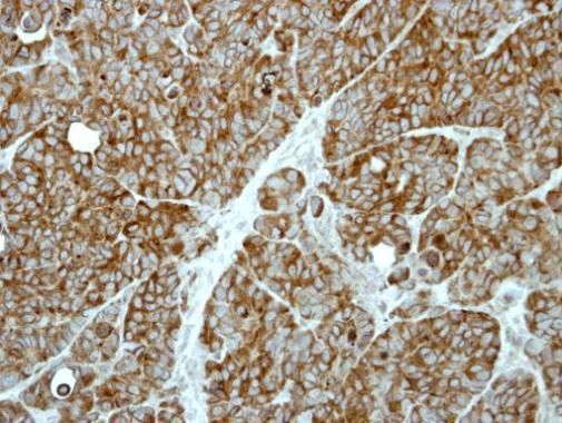MP1 antibody [N1C3]