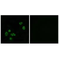 MPC1 Antibody
