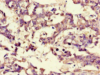 MPC2 Antibody